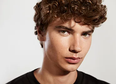 Acne scars treatment